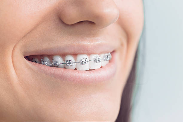 Best Traditional Braces  in Tulsa, OK